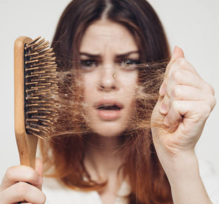 Common Causes of Hair Loss in Women